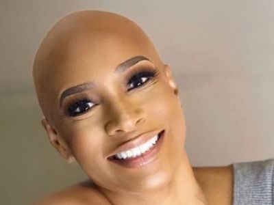 Kimmi Grant is smiling with her bald head in the picture.